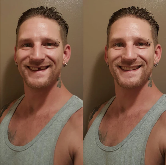 Dentfix