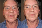 Dentfix