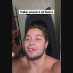 Instasmile