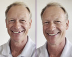 Dentfix